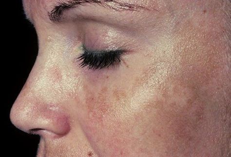 photo credits Pinterest-@Amyara